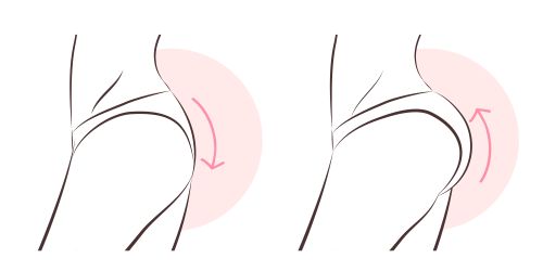 Beauty,Woman,With,Butt,Implant,Before,And,After